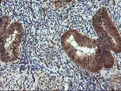 TRIM44 Mouse anti-Human, Clone: OTI1E10, lyophilized, TrueMAB 100 &mu;g;