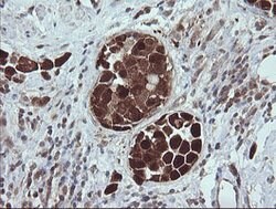 TRIM44 Mouse anti-Human, Clone: OTI1E10, lyophilized, TrueMAB 100 &mu;g;