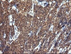 TRIM44 Mouse anti-Human, Clone: OTI1E10, lyophilized, TrueMAB 100 &mu;g;