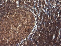 TRIM44 Mouse anti-Human, Clone: OTI1E10, lyophilized, TrueMAB 100 &mu;g;