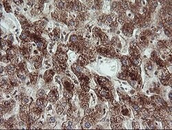 TRIM44 Mouse anti-Human, Clone: OTI1E10, lyophilized, TrueMAB 100 &mu;g;
