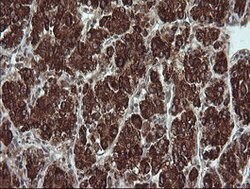 TRIM44 Mouse anti-Human, Clone: OTI1E10, lyophilized, TrueMAB 100 &mu;g;