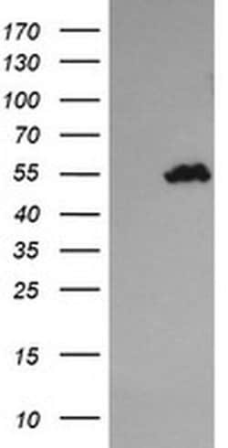 TRIM44 Monoclonal Antibody (OTI6F10), TrueMAB , OriGene:Antibodies:Primary