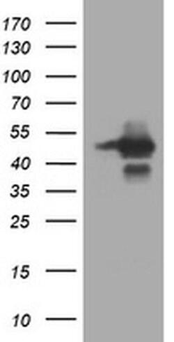 TRIM44 Monoclonal Antibody (OTI2B9), TrueMAB , OriGene 100 &mu;L; Unconjugated:Antibodies,
