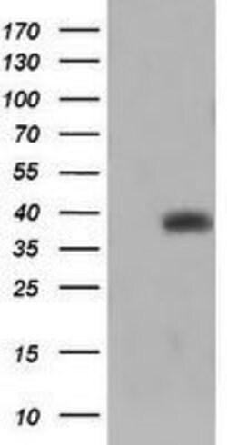 TRIM44 Mouse anti-Human, Clone: OTI1E10, lyophilized, TrueMAB 100 &mu;g;