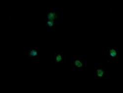 TRIM45 Monoclonal Antibody (OTI3G3), TrueMAB , OriGene:Antibodies:Primary