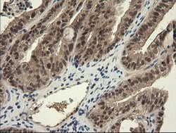 TRIM45 Monoclonal Antibody (OTI3G3), TrueMAB , OriGene:Antibodies:Primary