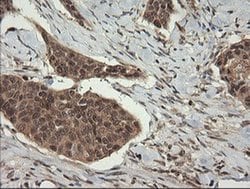 TRIM45 Monoclonal Antibody (OTI3G3), TrueMAB , OriGene 100 &mu;L; Unconjugated:Antibodies,
