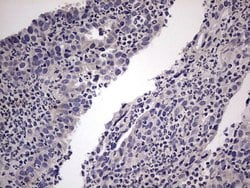 TRIM54 Mouse anti-Human, Clone: OTI7F8, lyophilized, TrueMAB 100 &mu;g;