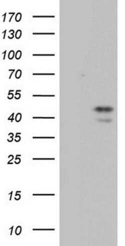 TRIM54 Mouse anti-Human, Clone: OTI6F5, lyophilized, TrueMAB 100 &mu;g | Buy Online | Origene Technologies | Fisher Scientific
