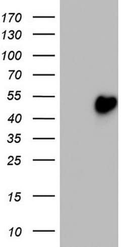 TRIM54 Monoclonal Antibody (OTI6A9), TrueMAB , OriGene 100 &mu;L; Unconjugated:Antibodies,
