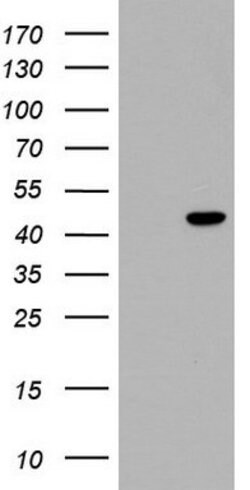 TRIM54 Mouse anti-Human, Clone: OTI6C3, lyophilized, TrueMAB 100 &mu;g | Buy Online | Origene Technologies | Fisher Scientific