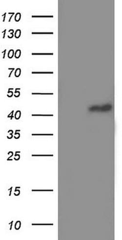 TRIM54 Monoclonal Antibody (OTI2A11), TrueMAB , OriGene 100 &mu;L; Unconjugated:Antibodies,