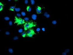 TRIM9 Monoclonal Antibody (OTI1E4), TrueMAB , OriGene 100 &mu;L; Unconjugated:Antibodies,