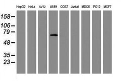 TRIM9 Monoclonal Antibody (OTI2A9), TrueMAB , OriGene 100 &mu;L; Unconjugated:Antibodies,
