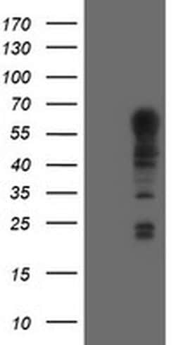 TRIM9 Monoclonal Antibody (OTI1G10), TrueMAB , OriGene 100 &mu;L; Unconjugated:Antibodies,