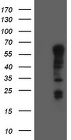 TRIM9 Monoclonal Antibody (OTI3C9), TrueMAB , OriGene:Antibodies:Primary