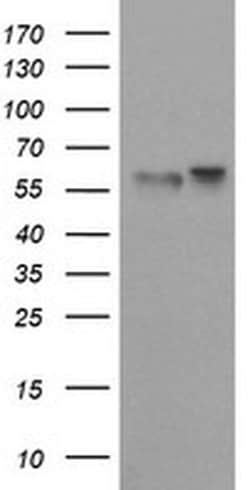 TRIM9 Monoclonal Antibody (OTI2D8), TrueMAB , OriGene:Antibodies:Primary