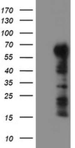 TRIM9 Monoclonal Antibody (OTI1E4), TrueMAB , OriGene 100 &mu;L; Unconjugated:Antibodies,