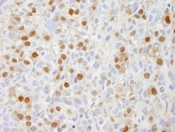 TRIP1/SUG1 Polyclonal Antibody, Bethyl Laboratories:Antibodies:Primary