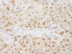 TRIP1/SUG1 Polyclonal Antibody, Bethyl Laboratories 100 &mu;l; Unlabeled:Antibodies,