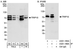 TRIP10/CIP4 Rabbit anti-Human, Mouse, Polyclonal, Bethyl Laboratories 100