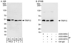 TRIP13 Rabbit anti-Human, Polyclonal, Bethyl Laboratories 100 &mu;L; Unconjugated:Antibodies,