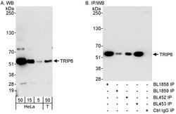 TRIP6 Rabbit anti-Human, Polyclonal, Bethyl Laboratories 100 &mu;L; Unconjugated:Antibodies,