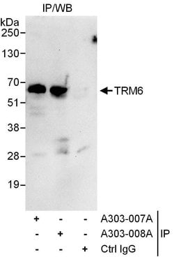 TRM6 Rabbit anti-Human, Polyclonal, Bethyl Laboratories 100 &mu;L; Unconjugated:Antibodies,