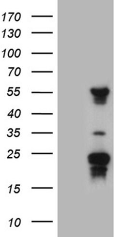 TRMT12 Monoclonal Antibody (OTI3C10), TrueMAB , OriGene 100 &mu;L; Unconjugated:Antibodies,