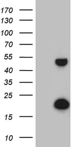 TRMT12 Mouse anti-Human, Clone: OTI3D1, lyophilized, TrueMAB 100 &mu;g;