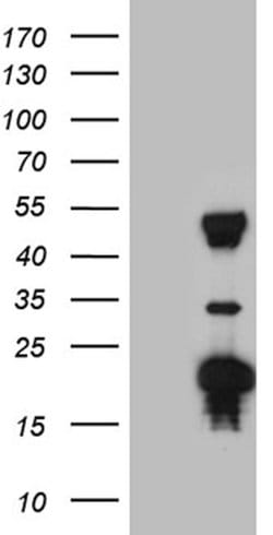 TRMT12 Mouse anti-Human, Clone: OTI1C9, lyophilized, TrueMAB 100 &mu;g | Buy Online | Origene Technologies | Fisher Scientific