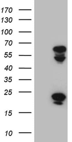 TRMT12 Monoclonal Antibody (OTI1C12), TrueMAB , OriGene 100 &mu;L; Unconjugated:Antibodies,