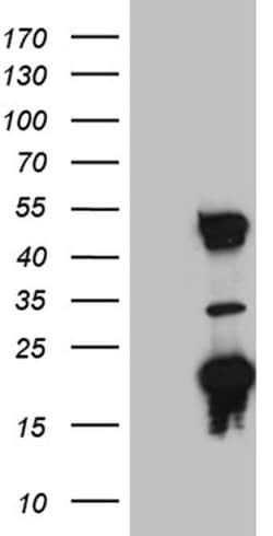 TRMT12 Monoclonal Antibody (5C9), TrueMAB , OriGene 30 &mu;L; Unconjugated:Antibodies,
