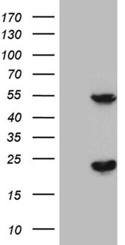TRMT12 Monoclonal Antibody (OTI3D2), TrueMAB , OriGene 100 &mu;L; Unconjugated:Antibodies,