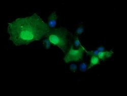 TRMT2A Mouse anti-Human, Clone: OTI2C6, lyophilized, TrueMAB 100 &mu;g;