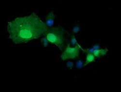 TRMT2A Monoclonal Antibody (OTI2C6), TrueMAB , OriGene 30 &mu;L; Unconjugated:Antibodies,