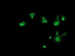 TRMT2A Monoclonal Antibody (OTI1H8), TrueMAB , OriGene 100 &mu;L; Unconjugated:Antibodies,