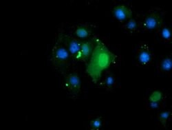 TRMT2A Monoclonal Antibody (OTI3D8), TrueMAB , OriGene 100 &mu;L; Unconjugated:Antibodies,