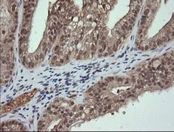 TRMT2A Monoclonal Antibody (OTI2C6), TrueMAB , OriGene 30 &mu;L; Unconjugated:Antibodies,
