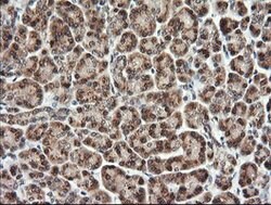 TRMT2A Mouse anti-Human, Clone: OTI2C6, lyophilized, TrueMAB 100 &mu;g;