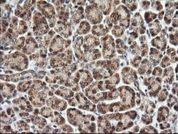 TRMT2A Monoclonal Antibody (OTI2C6), TrueMAB , OriGene 30 &mu;L; Unconjugated:Antibodies,