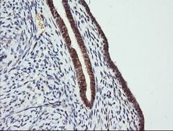 TRMT2A Mouse anti-Human, Clone: OTI2C6, lyophilized, TrueMAB 100 &mu;g;