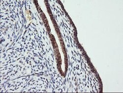 TRMT2A Monoclonal Antibody (OTI2C6), TrueMAB , OriGene 30 &mu;L; Unconjugated:Antibodies,