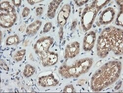 TRMT2A Monoclonal Antibody (OTI2C6), TrueMAB , OriGene 30 &mu;L; Unconjugated:Antibodies,