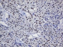TRMT2A Monoclonal Antibody (OTI2A1), TrueMAB , OriGene 100 &mu;L; Unconjugated:Antibodies,