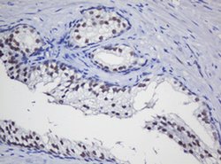 TRMT2A Monoclonal Antibody (OTI2A1), TrueMAB , OriGene 100 &mu;L; Unconjugated:Antibodies,