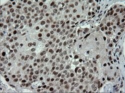 TRMT2A Monoclonal Antibody (OTI1H8), TrueMAB , OriGene 100 &mu;L; Unconjugated:Antibodies,