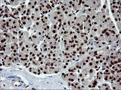 TRMT2A Monoclonal Antibody (OTI1H8), TrueMAB , OriGene 100 &mu;L; Unconjugated:Antibodies,