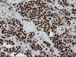 TRMT2A Monoclonal Antibody (OTI1H8), TrueMAB , OriGene 100 &mu;L; Unconjugated:Antibodies,